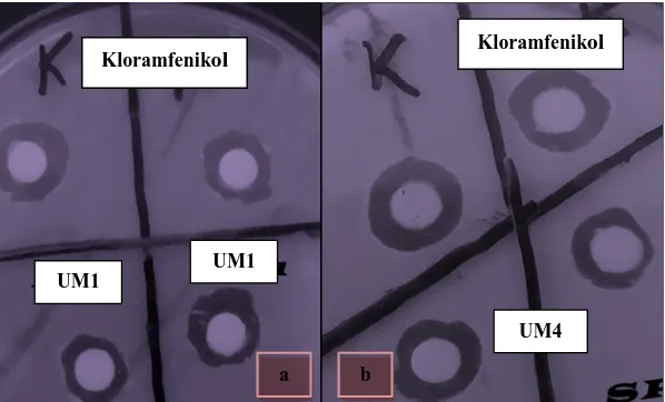 Gambar 4.5. Hasil Uji Antagonis Senyawa antimikrob selama 48 jam (a) Senyawa  antimikrob UM1 (b) Senyawa antimikrob UM4 terhadap Aeromonas salmonicida  