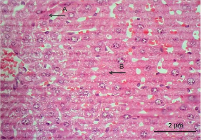 Gambar 8 Gambaran histopatologi jaringan hati yang diberi ekstrak Quassia indica. Lesio hepatosit berupa : Apoptosis (A) dan Degenerasi hidropis (B), Dosis 100 mg/kg BB