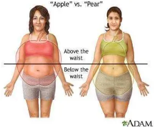 Gambar 4. Obesitas Apple Shapedd dan Obesitas Pear Shapedd (Diakses dari: http://img.medscape.com/fullsize/migrated/editorial/clinupdates/2001/608/cu02.fig09.gif) 