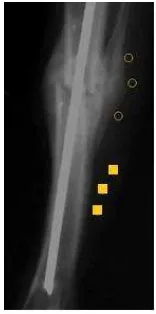 Gambar 11  Pengambilan data rasio densitas otot lesio ( ) titik 