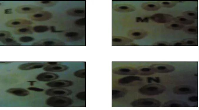 Gambar 3.  Sel darah Ikan Lele (Clarias ssp), Eritrosit (E), Limfosit (L),                             Monosit (M), Heterofil (N), dan Trombosit (T) (Abdullah 2008)