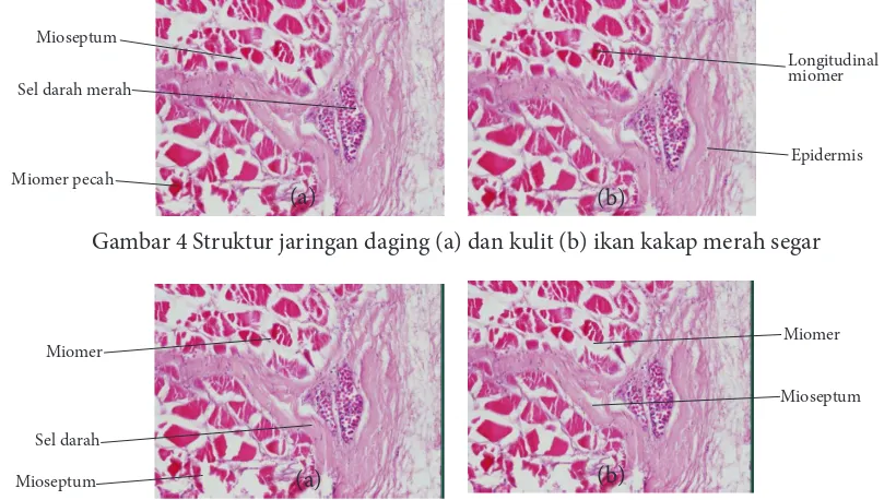 Gambar 5 Struktur jaringan daging (a) dan kulit (b) ikan kakap merah goreng
