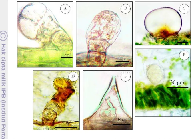 Gambar 5 Struktur sekretori pada tumbuhan obat antiinfeksi asal Telaga Warna. Trikoma kapitat dengan 2 sel kepala (A);  trikoma kapitat dengan banyak sel kepala (B); trikoma peltat (C); trikoma uniseriat (D); trikoma berisi kristal (E), dan  sel idioblas (