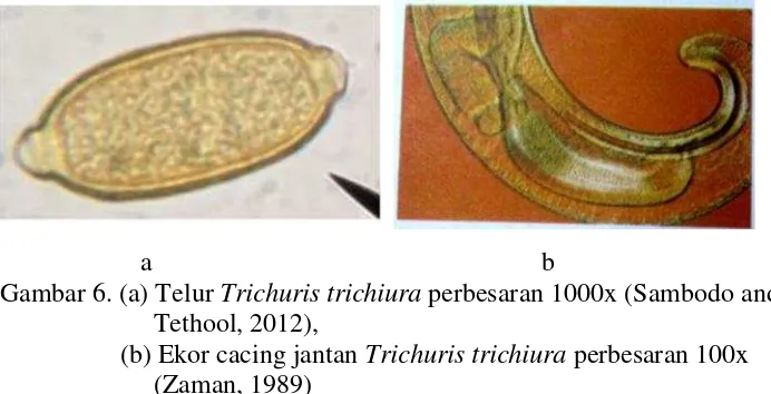 Gambar 6. (a) Telur Trichuris trichiura perbesaran 1000x (Sambodo and