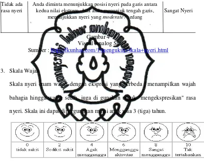 Gambar 4  Visual Analog Scale 