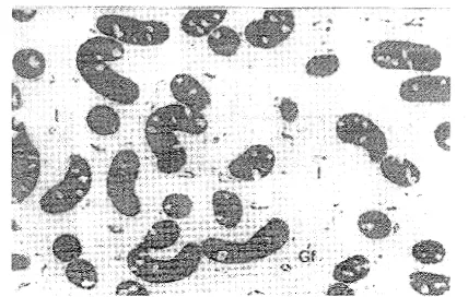 Gambar 4. Imunoreaksi protein S-100 pada sel-sel Sertoli. CRL 20 cm, 360x. I=instesitium; GF=pernbuluh darah 