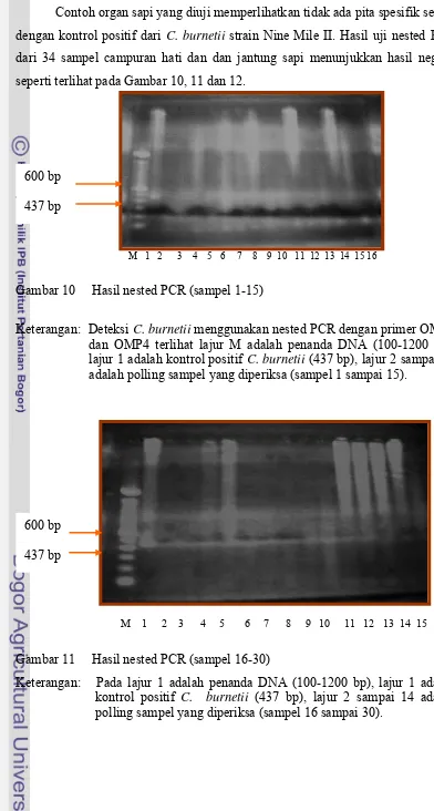 Gambar 10     Hasil nested PCR (sampel 1-15) 