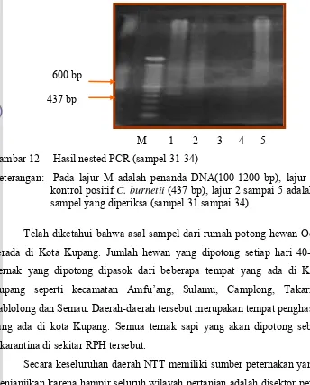 Gambar 12     Hasil nested PCR (sampel 31-34) 