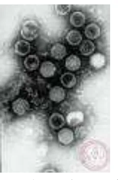 Gambar 3. Virus Marek Sumber: http://www. cdfa.ca.gof/2008 