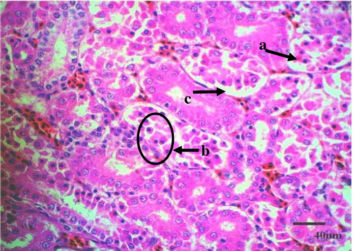 Gambar 8. Nekrosa: karyolisis (a), piknosis (b) dan degenerasi (c) sel-sel tubulus ginjal pada kelompok R1 (HE, bar= 40µm)