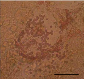 Gambar 8.  Sel-sel beta pankreas berbentuk bulat yang dihasilkan pada pengarahan ESC. Bar = 10μm 