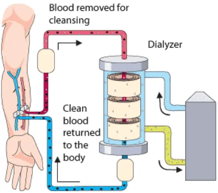 Gambar II-3 Proses hemodialisis 