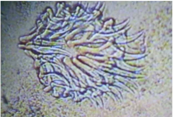 Gambar 6 Skoleks Cysticercus cellulosae yang terdiri dari empat buah alat pengisap (sucker)