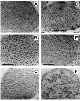 Gambar 8  Gambaran Histologi dari lobul testikular pada saat tahap perkembangan.  (a) Tahap I (spermatogonia proliferation stage)