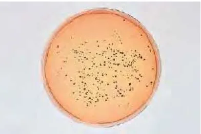Gambar 5  Koloni bakteri Staphylococcus aureus pada media agar Vogel Johnson  
