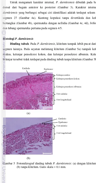 Gambar 5  Fotomikrograf dinding tubuh P. darnleiensis: (a) dengan klitelum dan 