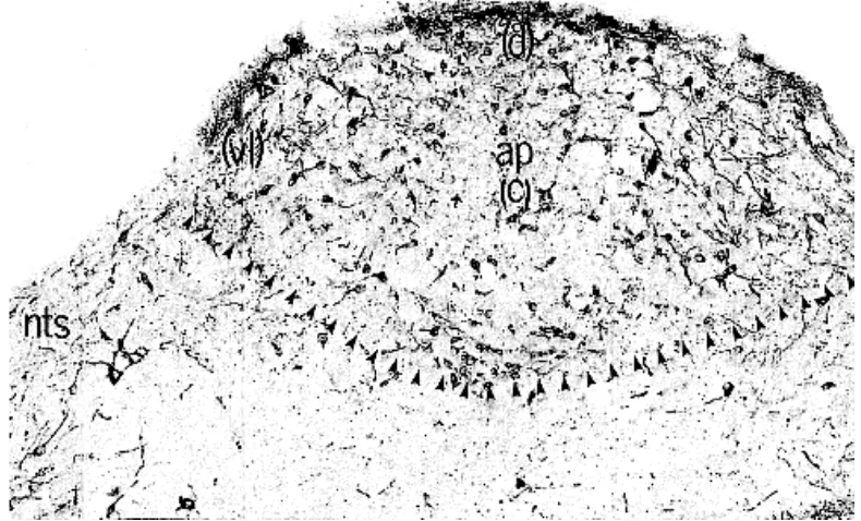 Gambar 9. Potongan koronal AP tikus dengan pewarnaan imunositokimia terhadap TH.  
