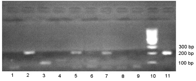 Gambar 3. Hasil elektroforesis produk RT-PCR dengan primer matrik: F-matrik-AI; R-Matrik AI (Lee et al