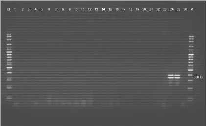 Gambar 5. Hasil PCR IS900 (TJ1-TJ2) sampel feses, pada kolom 1 – 22 adalah sampel,  