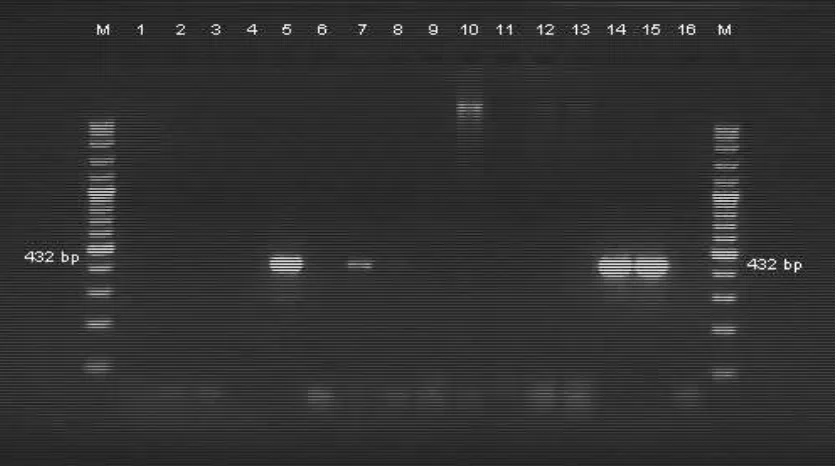 Gambar 8. Hasil PCR F57, pada kolom 5 (isolat Baturaden) dan 7 (isolat Lembang)   