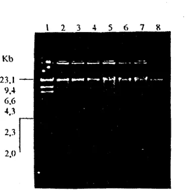 Figure 1. The electrophoresis of total DNA from soil samples. Column 1, DNA h Hind11 as molecular size marker;Column 2 - 8 Prokaryotic DNA in soil samples 