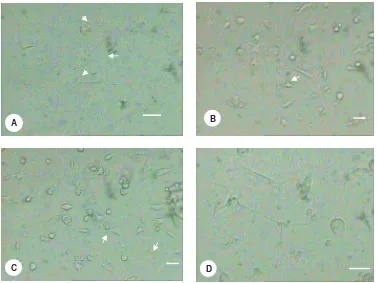 Gambar 6 Beberapa neural-like cells                                        Skala bar 5  yang teramati pada hari ke-7 μm (A, B, C) dan 7 μm (D) 