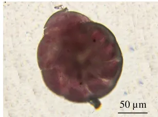 Gambar 9  Foraminifera.  
