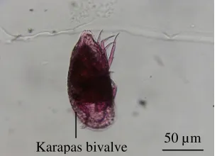 Gambar 11  Ostracoda.  
