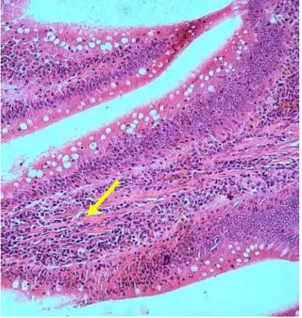 Gambar 1. Antigen H5N1 ditemukan pada  sel-sel      Gambar 2.  Usus terjadi kongesti dan infiltrasi   goblet usus (+++) (PIII) (obyektif 20 x                         limfosit  pada lamina propria (PIII)            metode imunohistokimia)                                              (obyektif  40x , HE)  