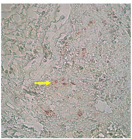 Gambar 5. Antigen virus H5N1 ditemukan pada        Gambar 6.  Paru-paru (PI) mengalami kongesti,                    organ paru-paru (++) (PI) (obyektif                             adanya perdarahan (obyektif 40 x ,     20 x , metode imunohistokimia)                                  HE)       