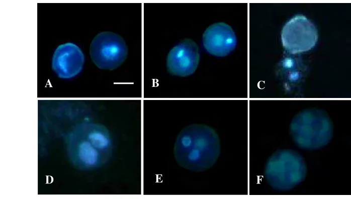 Gambar 2 Perkembangan mikrospora pada kultur antera kedelai varietas Slamet: (A) mikrospora 