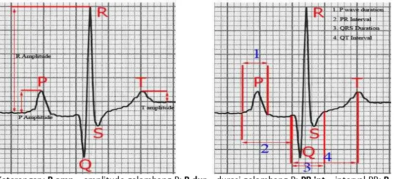 Gambar 11  Kertas rekam EKG beserta gambaran EKG normal (O’Grady dan O’Sullivan 2004) 