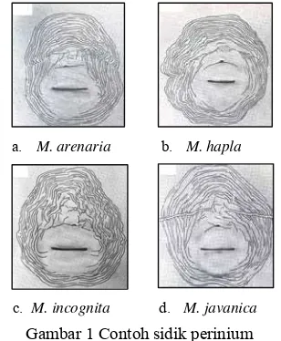 Gambar 1 Contoh sidik perinium 