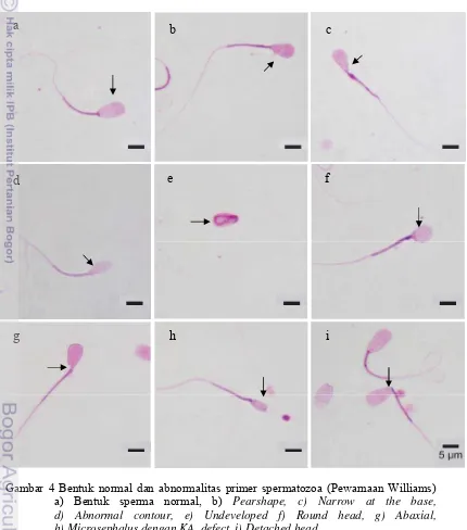 Gambar 4 Bentuk normal dan abnormalitas primer spermatozoa (Pewarnaan Williams)   