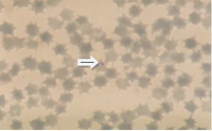 Gambar 3  Theileria sp. di dalam sel darah merah. 