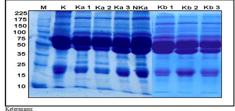 Gambar 1. Karakter protein hasil elektroforesis terhadap serum sapi potong yang positif  CFT dan I-ELISA  