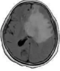 Gambar 2.1 Gambar Citra MRI yang diekstraksi