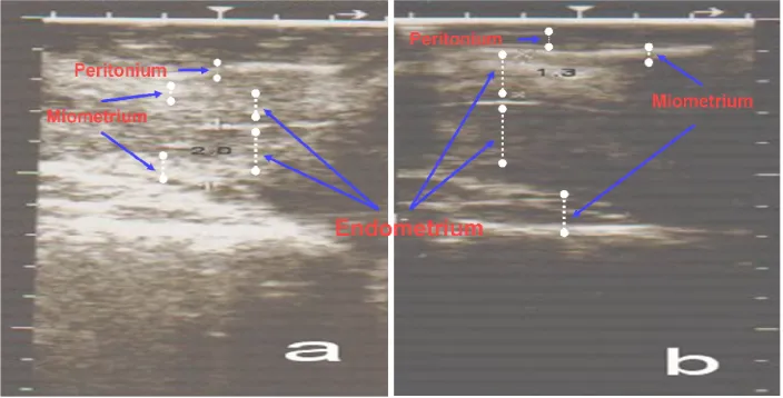Gambar 10. Gambaran ultrasonografi dinding endometrium uterus sapi endometritis.  Sebelum (a) dan setelah diterapi (b) dengan menggunakan kombinasi antibiotik+PGF2α