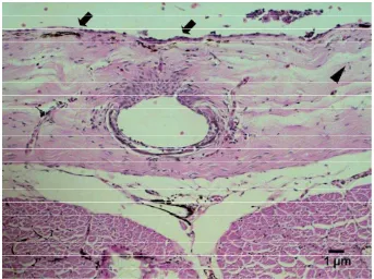 Gambar 15.   Akumulasi sel radang pada subkutan kulit ikan lele (tanda panah) dan dermatitis ulseratif (tanda kepala anak panah) pada jam ke-48 pi E