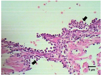 Gambar 27. Kondisi hiperleukositosis ditunjukkan oleh akumulasi leukosit dalam lumen 