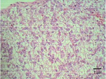 Gambar 35. Degenerasi lemak pada jaringan hati ikan lele jam ke-46 pi E. ictaluri, Pewarnaan HE, skala1µm 