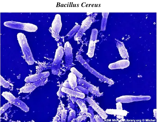 Gambar 2  Gambaran B. cereus menggunakan mikroskop elektron.    (Disadur dari ASM Microbe Library.org )  