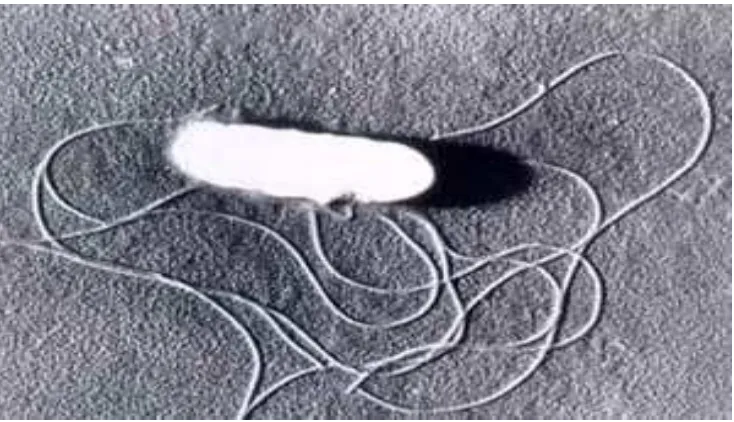 Gambar 1  L.  monocytogenes berflagela peritrikus diamati dengan mikroskop elektron (Anonimus 2005) 