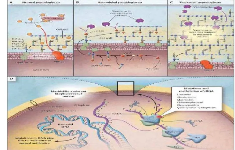Gambar 2 Mekanisme resistensi bakteri gram positif (Sumber: Arias dan Murray,