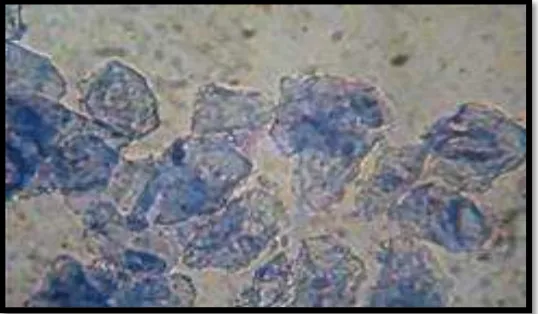 Gambar 3. Mikrograf Epitel Vagina Tikus Putih Fase Estrus Perbesaran 40X (Dokumentasi Penelitian, 2017) 