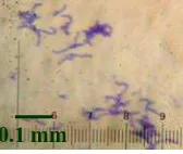 Gambar 1 Morfologi koloni Streptococcus spp. di