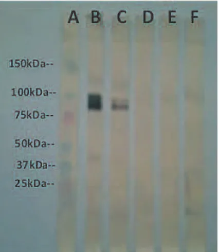 Gambar 2. Pengukuran Titer AbMo Anti-C.Cellulosa.  Titer AbMo BE6 dan BE7di atas 27;  EE9 23;  AC6, EC1, DC1,BG8 negatif