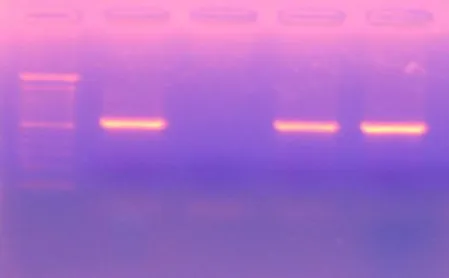 Gambar 1. Gambar dari gel agarose 1% yang diwarnai dengan ethidium bromide dan visualisasikan dengan UV ransluminator