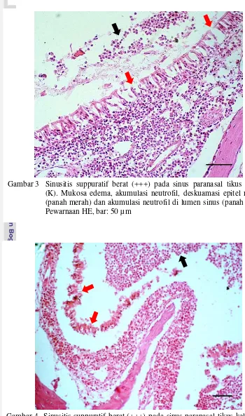 Gambar 4 Sinusitis suppuratif berat (+++) pada sinus paranasal tikus kelompok perlakuan (P)