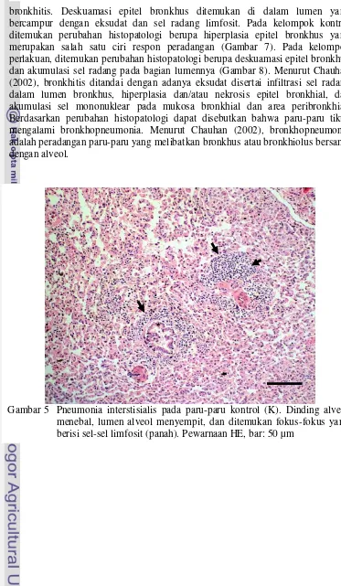 Gambar 5 Pneumonia interstisialis pada paru-paru kontrol (K). Dinding alveol  menebal, lumen alveol menyempit, dan ditemukan fokus-fokus yang berisi sel-sel limfosit (panah)